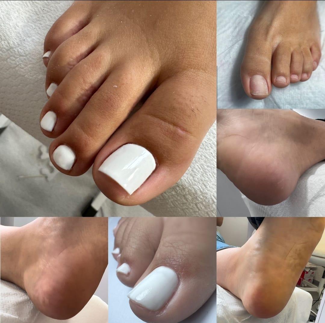 קורס פדיקור פרא-רפואי